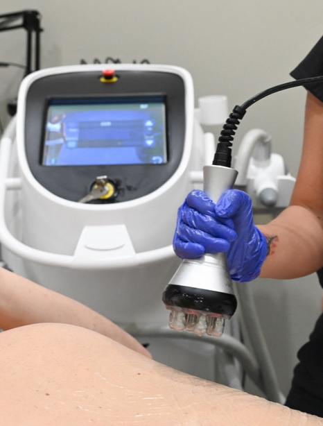 Discover the Best Laser Hair Removal in Miami