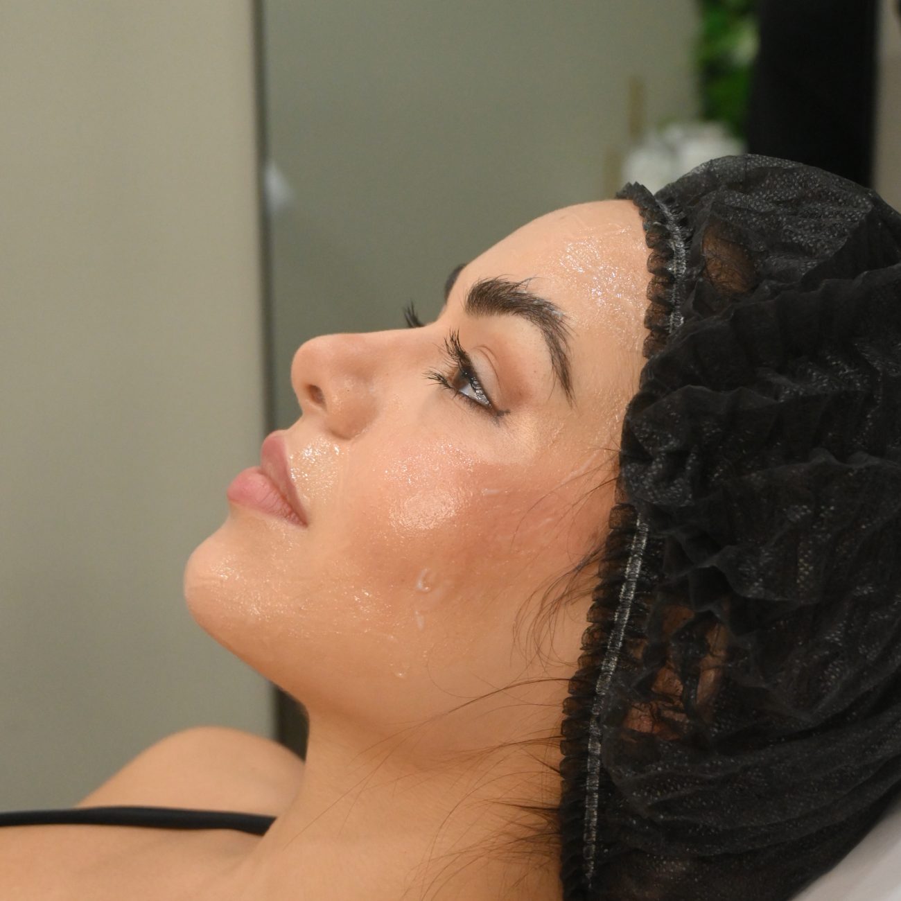Top 5 Benefits of Botox at Artemis Med Spa Miami